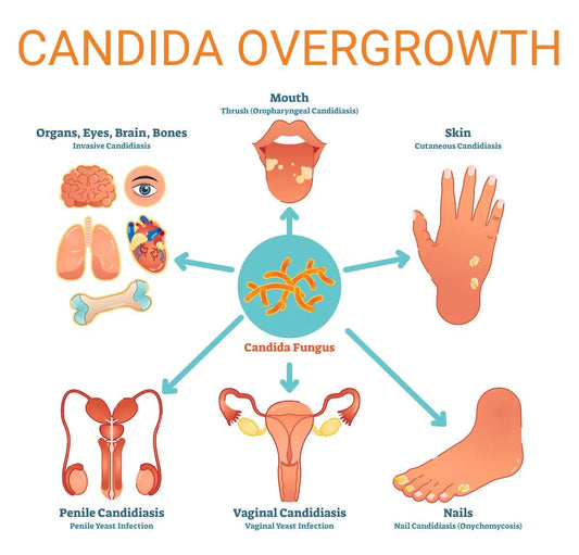 Taheebo Tea for Candida Overgrowth and Fungal Infections